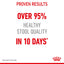 Royal Canin Nutrition Digestive Care Dry Cat Food 400g & 2kg